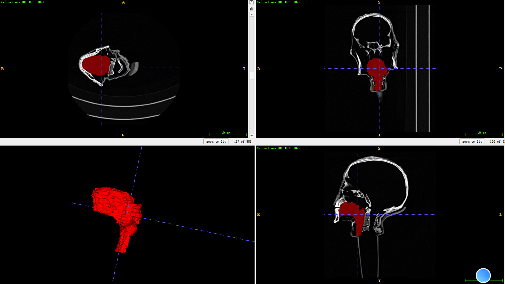 Processing of the 3D model of the vocal tract based on the available computed tomography data of the mummy.